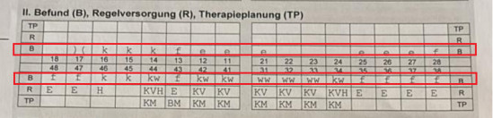 Zahnbefund im Zahnschema